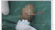 整形外科男士们男性医院求美者占卷颜值(男性自己的整形外科医院手术)