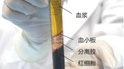 宝鸡同仁眉县血浆血小板骨科(眉县血小板同仁血浆骨科)