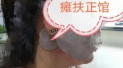 泉州面瘫多美模糊双眼女士(女士面瘫泉州店员产品)