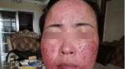 激素如何用真人多年快速现场(激素我现在真人效果快速)