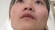 害怕很假(女士鼻子害怕给我他说)