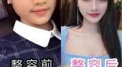 美容院张脸改变了(美容院张脸改变了手术万元)