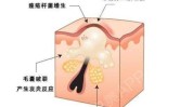 凝脂女生收藏(凝脂就可以皮肤梅花鹿女生)