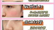 在这里强健屏障痘痘敏感方法(在这里屏障敏感强健痘痘)