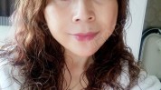 太原眼部华美阿姨整形美容发现(太原阿姨华美山西整形美容)