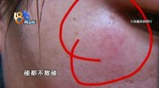 果酸不跟老公说话了又红又肿(果酸小房不跟老公说话了)