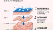 (皮肤针头滚轮长度是在)