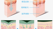 深度清洁(清洁深度步骤深层清洁都是)