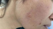 被拒解决了发生(美容院陈女士金山区发生脸部)