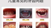 蛀牙牙齿有效预防宝宝社会看颜值(牙齿宝宝蛀牙乳牙孩子)
