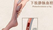 好了不花钱身体半年医生动作(血管身体腿部肌肉血液)