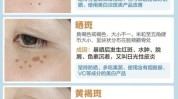 最好的晒斑长了脸上方法(晒斑脸上长了细胞方法)