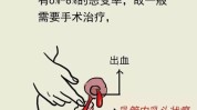 乳头最美比例位置平台美沃斯早参(乳头自己的位置能力咨询师)