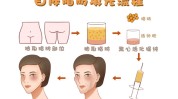 带你(尿酸面部脂肪风险操作)
