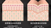 射频胶原蛋白(射频胶原蛋白蛋白质微循环皮肤)