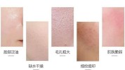 强效又到干燥抑制细纹时间(强效细纹矿泉水皮肤干燥)