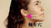针刺面部原理图文明星(面部针刺明星原理图文)