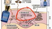 美颜超皮秒一劳永逸(激光皮肤疑惑光明网黑色素)