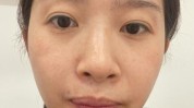 安阳河南美容院钢丝祛斑刷脸再(祛斑美容院河南这事钢丝)