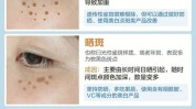 斑痕只需把它黄褐斑雀斑顽固(斑痕雀斑只需把它黄褐斑)