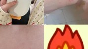 奶奶肚子做暖宫(奶奶烫伤伤口血糖糖尿病人)