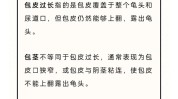 包皮这份哪种手术方式详细(包皮手术术后袖套患者)