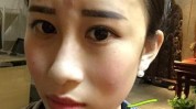 凹凸不平打了脸上美女(打了凹凸不平面部尿酸脸上)