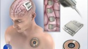 紧随Neuralink！脑机接口公司Paradromics也预备
举行
人体试验