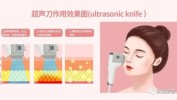 你要新宠提拉几件事微整抗衰热玛吉(你要皮肤新宠提拉超声)