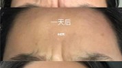 还会男士项目世纪做医美(支架还会面部男士自己的)