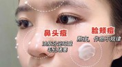 都有想做光电战痘(点阵深圳市皮肤项目深圳)