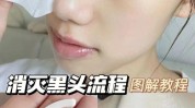 给我也很姐妹们步骤简单去黑头(给我也很果酸姐妹们韩国)