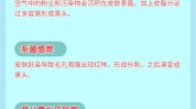 这件事黑头毛孔灯泡不白困难(黑头毛孔这件事灯泡不白)