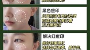一遍个月手把手教你红黑方法痘印(痘印红黑一遍方法个月)