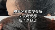 低成本女士们方法女人(头发让您低成本头皮方法)