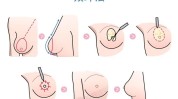 让你做个抬头方法女人有哪些(手术胸部脂肪方法让你)