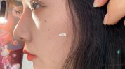 秦皇岛不具备资质一大一除皱眼睛(机构资质女士秦皇岛尿酸)