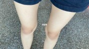 膝盖这款教你溶液美白白嫩(膝盖溶液美白自己的小美)