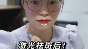 还会教你一招祛斑肤质反黑(祛斑激光反黑还会黑色素)
