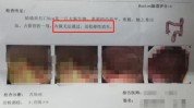 一颗算不算(病理手术省城一颗朝乾夕惕)
