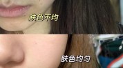 肤色不均匀做什么油光项目(肤色不均匀做什么油光皮肤)