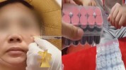医疗美容针剂犯罪案件(医疗美容当事人万元长沙市医疗器械)
