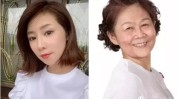 的人隔三差五做医美(的人妈妈小李自己的青山)