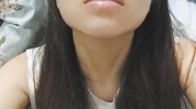 歪了贷款鼻子机构(鼻子红星机构小雅贷款)