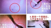 新西兰沙龙(新西兰头皮沙龙头发毛囊)