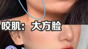 用了几种方法让脸小(瘦脸用了魔镜脂肪面部)