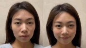 面部高阶思路项目幼态脸(面部轮廓外轮高阶耳朵)