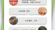 头皮更重要努力项目系统(头皮项目陆海空系统更重要)