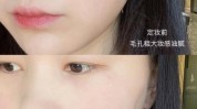 美颜毛孔一键有什么办法(毛孔美颜一键有什么办法肌肤)