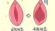 外阴要注意秘密花园女性皮肤科医生(外阴女性在线家庭医生局部)
